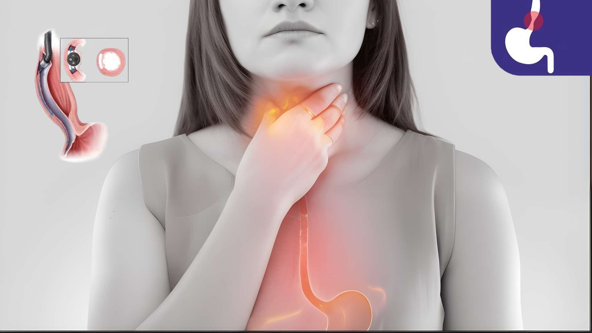 The Essential Guide to Sleeping Better with Achalasia