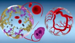 Breakthrough Treatments for Pulmonary Embolism